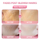 1fl oz B3 Face Serum for Wrinkles, Dark Spots, and Anti-Aging Pink Iolaus