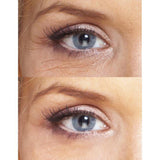 Biotic Repair Eye Treatment Hyperion