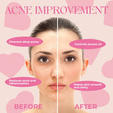Turmeric & Kojic Acid Face Wash Pink Iolaus