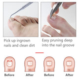 Pedicure Care Tool Set - Available in Black, Red or Blue