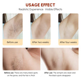 Laser IPL Hair Removal Device Pink Iolaus