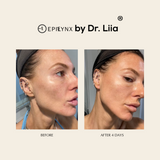 Epilynx Pore Refining Serum